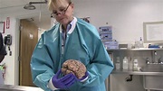 "The Brain Of A Boxer", Documentary Available April 6th - Boxing Over ...