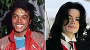 ¿Por qué la piel de Michael Jackson se volvió blanca? | Salud180