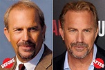 Kevin Costner Hair Transplant - Lots of Celebrities like Kevin Costner ...