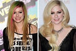 Avril Lavigne Before and After Plastic Surgery: Nose, Face, Boobs