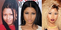 Nicki Minaj Plastic Surgery Before and After Pictures 2021