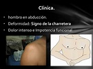 PPT - Luxación de Hombro. PowerPoint Presentation, free download - ID ...