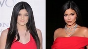 Kylie Jenner | El antes y el después de los retoques estéticos...