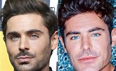Zac Efron: ¿Botox, cirugía plástica?, el actor revela el motivo del ...