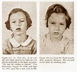 Do You Need a Lobotomy? Just Look at the Results From These Before and ...