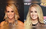 Emotional Carrie Underwood Confesses The Truth About Her Post-Accident Life
