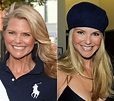 Christie Brinkley before and after plastic surgery – Celebrity plastic ...