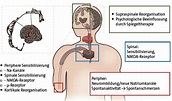 Phantomschmerzen - Neue Therapie-Impulse • doctors|today