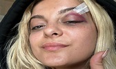 Cantora Bebe Rexha é atingida por celular durante show em Nova York ...