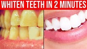 How to Whiten Teeth in 2 Minutes PERMANENTLY with This Secret Trick ...