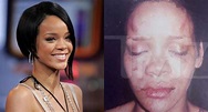 CelebPinkGossip: Foto: Rihanna golpeada
