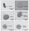 Figure 3 from Identification of Entamoeba histolytica trophozoites in ...