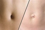 Innies Vs. Outies - What Decides The Shape Of Your Belly Button?