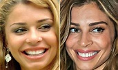 10 antes e depois do sorriso das famosas