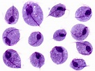 Lab Diagnosis of Trichomonas vaginalis infections – Microbe Online