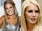 The Ever Changing Look of Heidi Montag’s Before and After Plastic ...