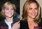 Mary Mccormack Plastic Surgery Before and After | Top Piercings
