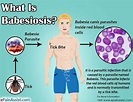 Babesiosis - Diseases - AntiinfectiveMeds.com