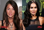 Megan Fox Before and After Plastic Surgery: A Tale of Evolution | ASEAN TV