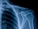Röntgen • Risiken, Vorteile & Ablauf der Untersuchung