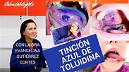 Tinción Azul de Toluidina - YouTube