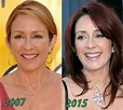 Patricia Heaton Plastic Surgery Before and After | Patricia heaton ...