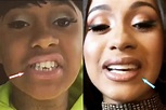 Cardi B Plastic Surgery REVEALED! (Before & After Photos 2021)