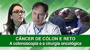 Câncer de Cólon e Reto - A colonoscopia e a cirurgia oncológica - YouTube