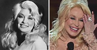 Dolly Parton's plastic surgery transformation | Now To Love