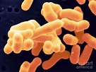 Bifidobacterium Adolescentis Photograph by Scimat - Pixels