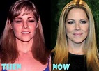 Mary McCormack Plastic Surgery Before and After Photos - Lovely Surgery ...