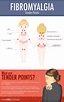 Fibromyalgia Tender Points: What and Where Are the Tender Points of ...