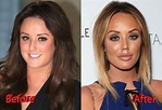 Charlotte Crosby Nose Job: A Transformation