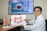 馬偕紀念醫院 技術提升 避免瘜肉變癌 - 台灣教會公報新聞網