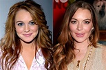 13 Of The Most Drastic Celebrity Plastic Surgeries