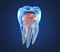 Endodoncia en Madrid | Nervio dental | Tratamiento de conductos | Tiiz