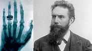 1895: Röntgenstrahlen von Wilhelm Conrad Röntgen | Rayos x, Rayos, Historia