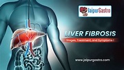 What is Liver Fibrosis: Stages, Treatment, and Symptoms - JaipurGastro