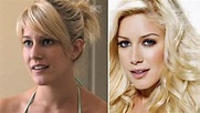 The Ever Changing Look of Heidi Montag’s Before and After Plastic ...