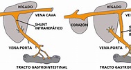 Derivaciones Portosistémicas - Rabito Kontento