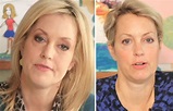 Ali Wentworth Plastic Surgery Before And After