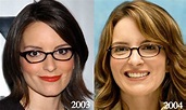Tina Fey Plastic Surgery - Tina Fey Scar Before and After Photos ...