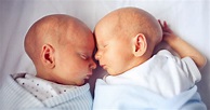 Jumeaux : pourquoi privilégier l’accouchement par voie basse