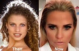 Katie Price Plastic Surgery Before and After Photos