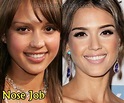 Jessica Alba Plastic Surgery Before and After - Plastic Surgery Hits in ...