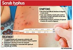 Over 300 people infected with scrub typhus in 20 districts