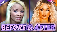 Trisha Paytas | Before & After | Plastic Surgery, Liposuction ...