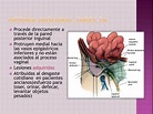 PPT - Hernia inguinal PowerPoint Presentation, free download - ID:2097299