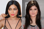 Kylie Jenner before surgery: Plastic surgeon gives verdict on starlet's ...