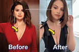 Selena Gomez Before And After Breast Implants